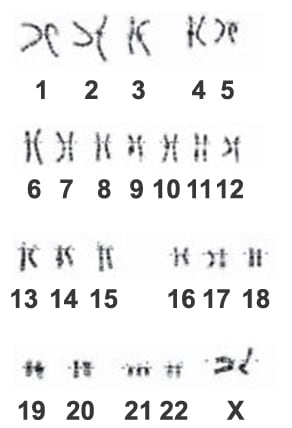 Por que acontecem anomalias numéricas de cromossomos?